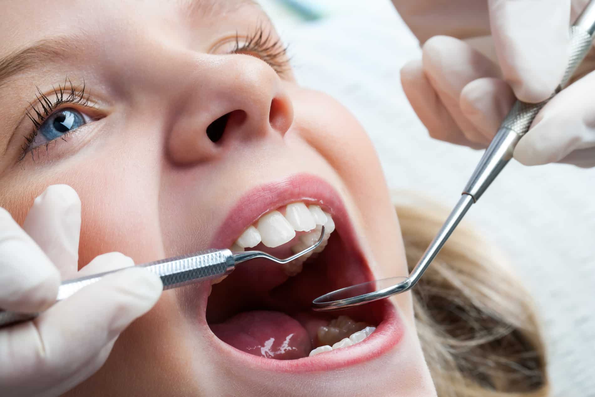 Child gets a dental cleaning in Lawrence, KS and Lenexa KS