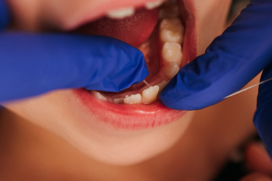 Child after a routine dental cleaning in Lawrence and Lenexa, KS